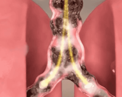 Lucky Plant Green Plants Wood【King of Lung Healing】